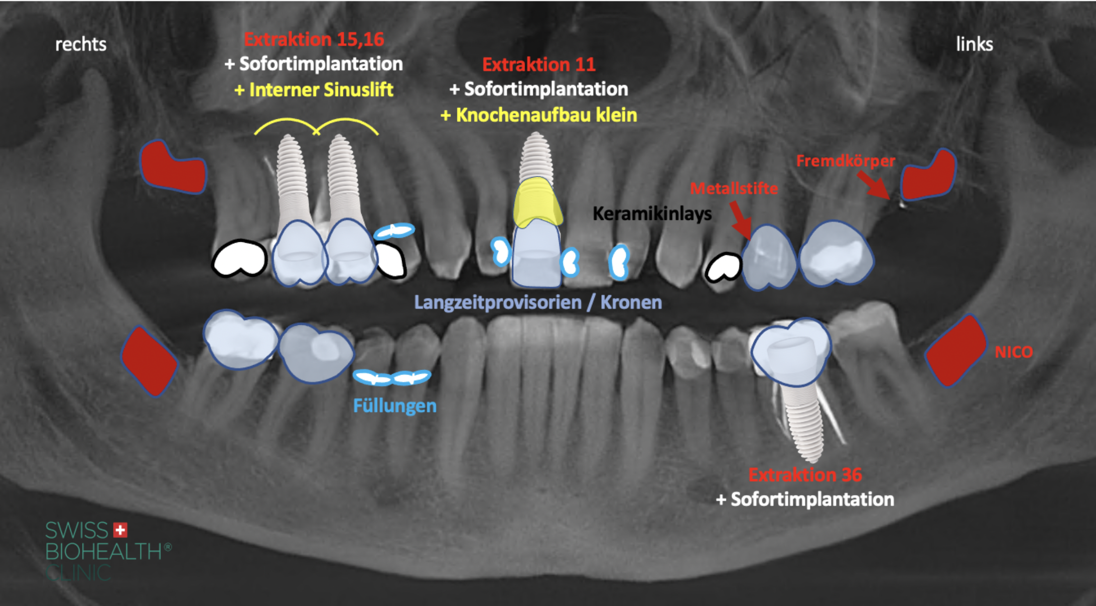 2D Panoramic X-Ray example